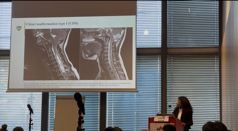 vagus nerve stimulation