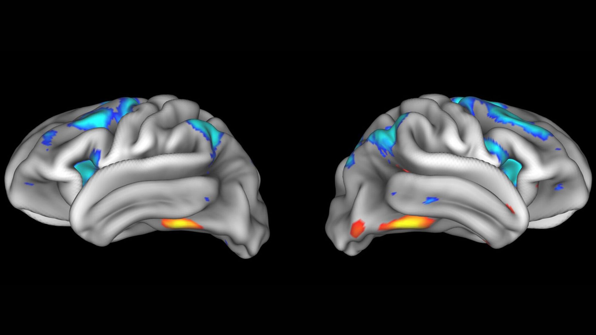 Neuroscience