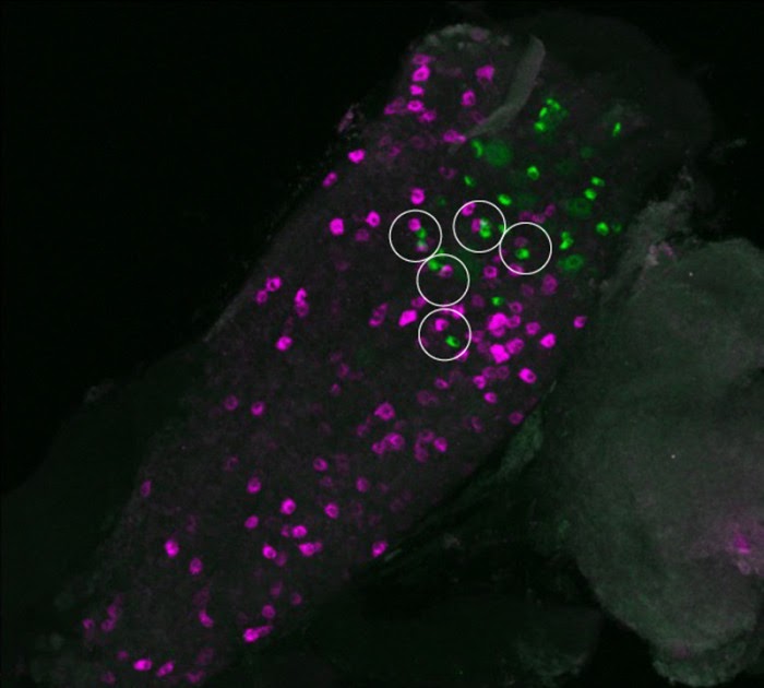 Personal Digest: Ear shots calm lungs — vagus nerve breakthrough