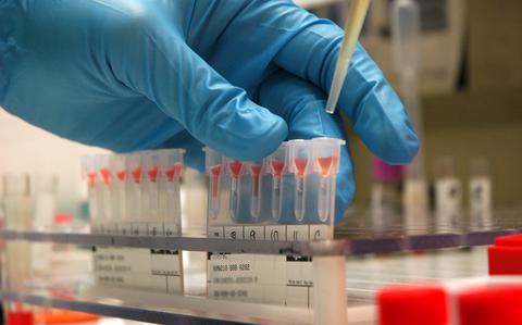 Cryopreservation